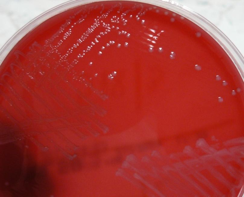 Příloha 6: Enterococcus faecalis - růst na