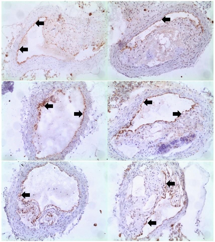 Obrázek 11: Reprezentativní obrázky imunohistochemického barvení enos u skupiny LCHP.
