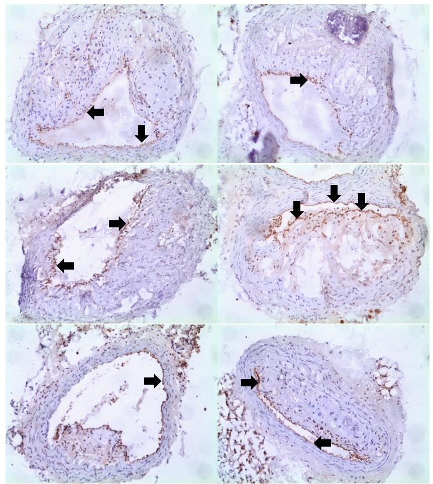 Obrázek 12: Reprezentativní obrázky imunohistochemického barvení enos u skupiny LCHP + nikotinová kyselina.