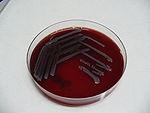 E. coli na krevním agaru E.