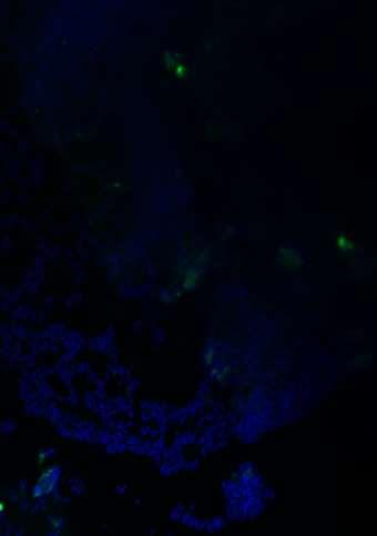 5: DAPI a Cy5 