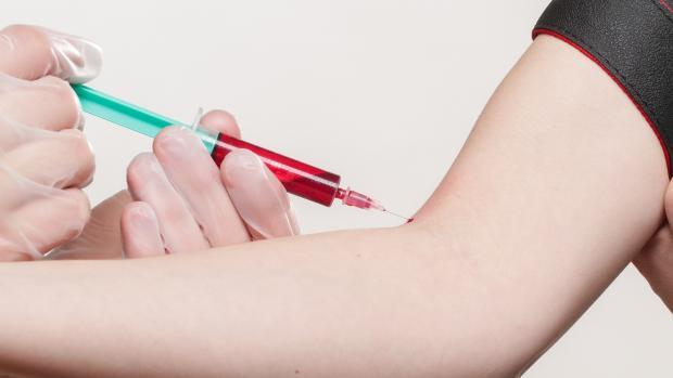 3.2 Podmínky vstupu Dárcem se může stát každý ve věku od 18 do 40 let, který váží nad 50 kg, je ochoten pomoci jakémukoli pacientovi nejen z ČR, ale i ze zahraničí.