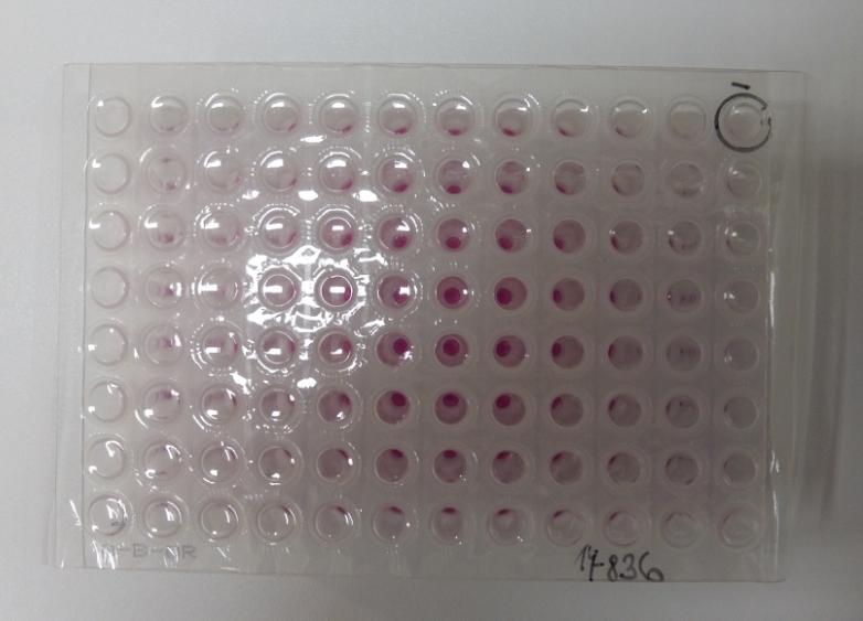 5. Nanesení 10 μl směsi do jamky negativní kontroly. 6. Přidání 12 μl promíchaného vzorku DNA pacientky do reakční směsi - krátká centrifugace. 7.