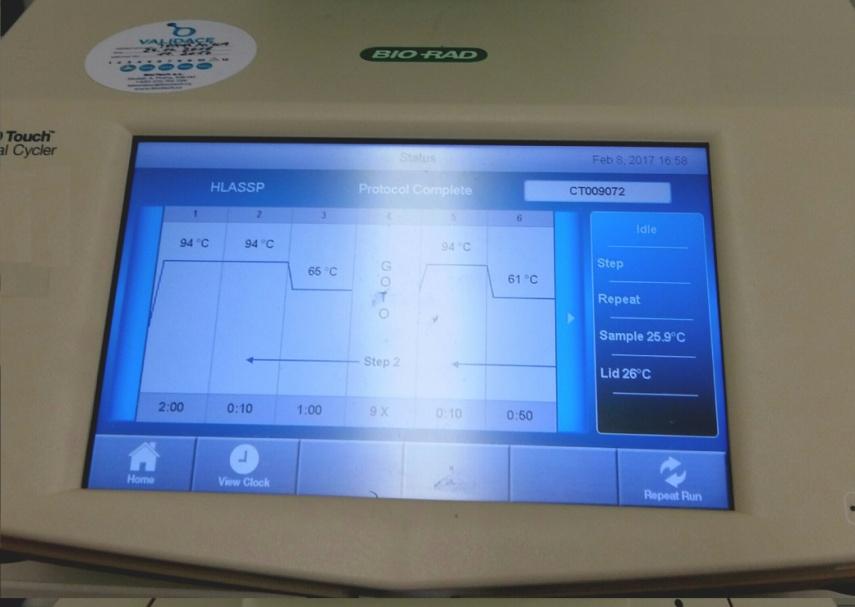 Tabulka 3: Průběh amplifikačního programu PCR-SSP [26] Průběh amplifikace Teplota [ C] Čas [s] Proces Iniciační cyklus 94 120 Denaturace 10 cyklů 94 65 20 cyklů 94 61 72 10 60 10 50 30 Denaturace