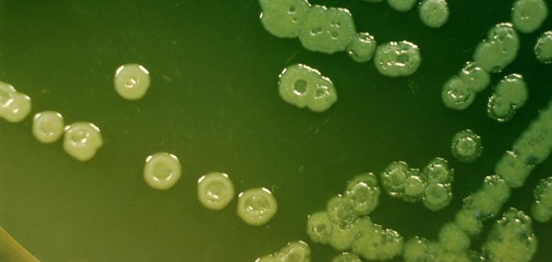 Pseudomonas aeruginosa typický původce NN Zelený pigment svědčí o tom, že jde o bakterii