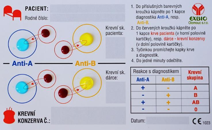 Kontrolní zkoušky vhodnosti kompatibility krve Tyto zkoušky se provádějí při aplikaci plné krve a přípravků s obsahem erytrocytů