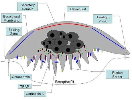 Osteoklasty