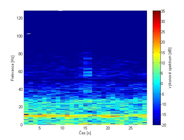 Příkladem spektrogramu je Obrázek 4.15. Pro jeho vytvoření byla použita náhodná epocha odpovídající fázi W, použité parametry byly popsány výše.