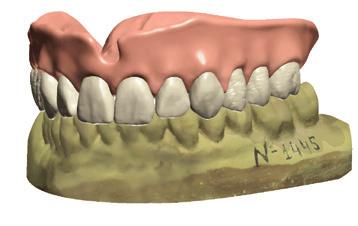 Naskenujte model sádry s voskovým valem, funkční otisk nebo lžíci vytvořenou ze stávající protézy plné dentice s připojeným sádrovým