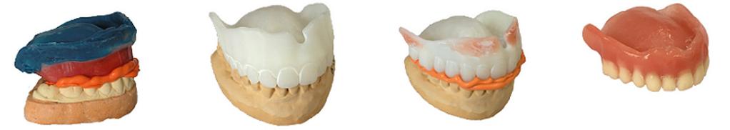 Rozšířená škála dentálních knihoven Společnost 3Shape zavedla další dentální knihovny a otevřela technikům nové možnosti používat zuby