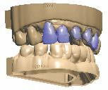 + 80247011) ZDARMA přiloženo Laboratorní skeny Dental Wings Není potřeba žádný doplněk, pokud jsou skeny dělené Model Builder STL (Číslo položky