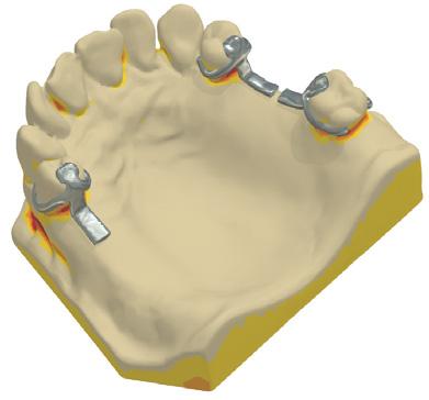 Tato možnost se nastavuje na straně Rámy na ovládacím panelu systému Dental System.