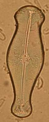 Didymosphenia geminata valvární pohled: raphe, centrální a terminální noduly Už při středním zvětšení lze pozorovat, že se