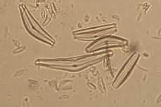 Cymbella cymbiformis (trvalý preparát) Rod Cymbella je charakteristický