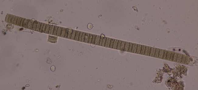 Řád Oscillatoriales cvičení 1, vzorek 1