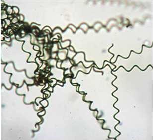 Řád Oscillatoriales Arthrospira spp.