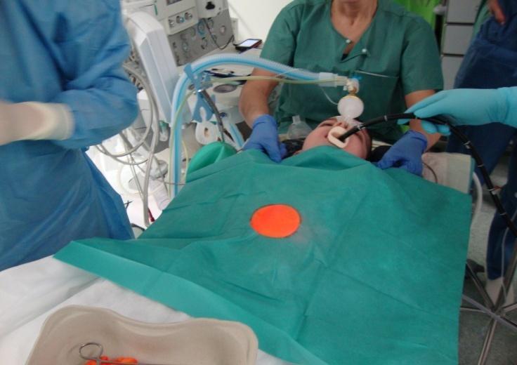 Zavedení PEGu gastroskopie změny na jícnu při GER, oblast kardie, průchodnost do duodena vyhledání vhodného místa