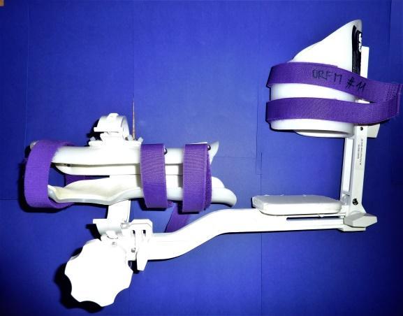 4.3 JAS GL Pronation/supination - Progresivní ortéza určená pro pronaci a supinaci Umožňovaný rozsah: pro pronaci do 110 0 a pro supinaci do 130 0 Využití: zlomeniny v oblasti lokte, tlaková