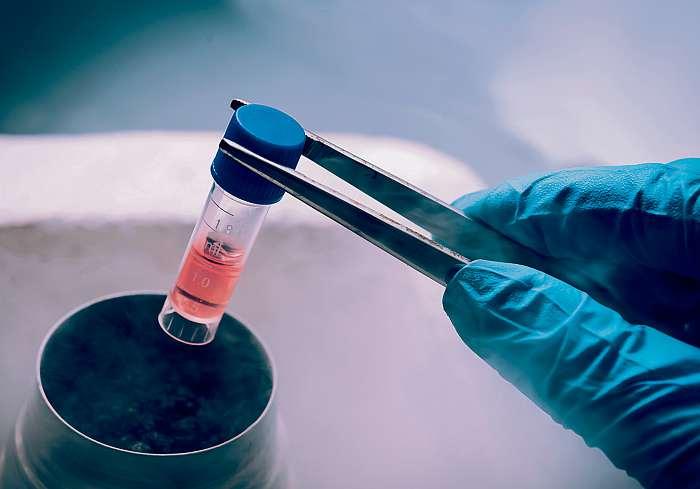 Spolupracujemesešpičkovýmicentry, cožjsou převážně univerzitní kliniky, a jejich lékaři metodu výborně znají adnes užrutinně aplikují.