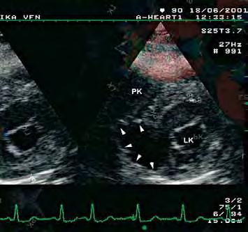 PRAGUECHO 2010 April 15 th, 2010 8 th Prague International Meeting on Advances in Echocardiography, organized by Working Group on Echocardiography of Czech Society of