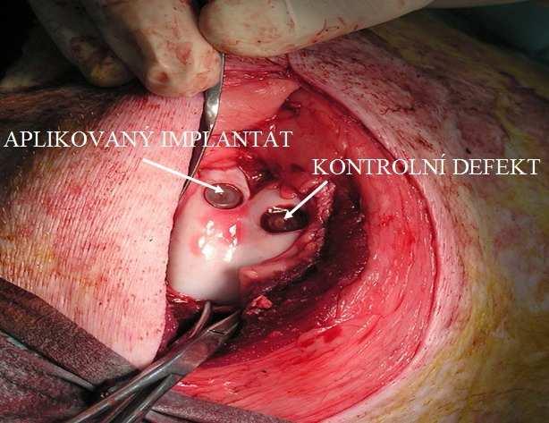 Obr. 18: Detail operovaného kolena[20] Bioaktivita, biokompatibilita a biokondukce (kolagenů I.