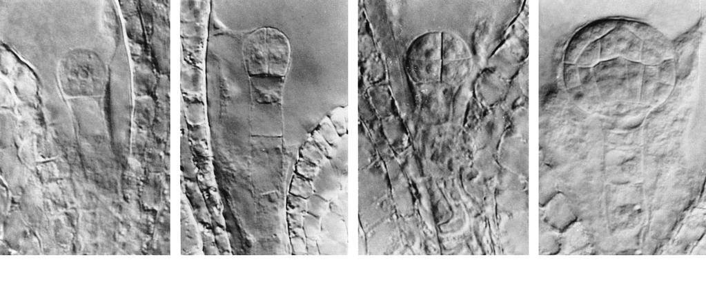 MBR 2 g) Tvorba semen Semeno krytosemenných: - embryo - endosperm -