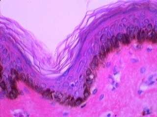 Melanocyty - derivují z gangliové lišty, - syntéza pigmentu melaninu (zrna = melanosomy) - těla buněk ve str.