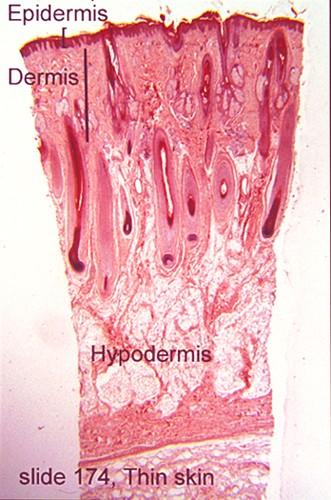Stavba kůže: epidermis pokožka dermis škára, corium hypoderm(is)