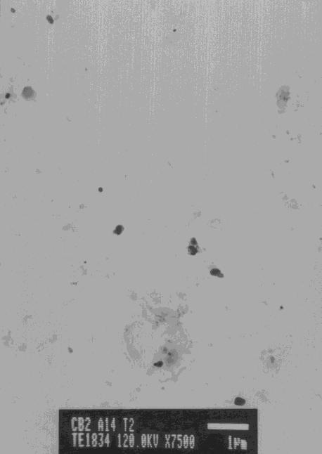 13.6. Vzorky A1 a A14 elektrochemicky leptané do 2. a 3. oblasti pásma transpasivity Čitelnost snímků elektrochemicky odleptaných do 2. a 3. oblasti je již horší, jelikož dochází k většímu odleptávání i matrice.