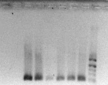 -> VC ---> ethene Control: 11B 37 HLV5 HBD4 IS17 IS15 Marker 1500bp 1377bp specific product