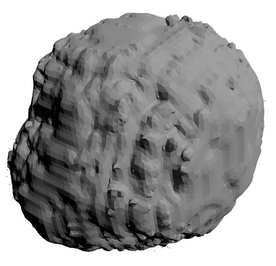 5.3 Testování 3D dat Pro testování metody ve 3D provedení byla použita reálná pacientská data získaná v rámci výzkumů probíhajících na Ústavu biomedicínského inženýrství.