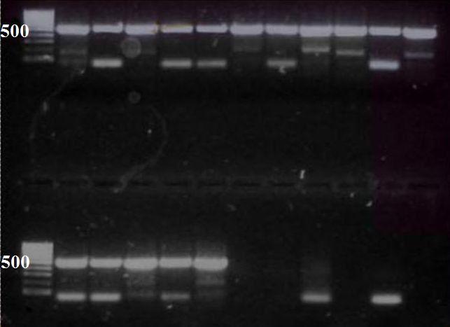 28-35 kda (obr. 26). 1.15. PCR Obr. 26 Gelatinolytická aktivita peptidáz ve vzorcích solpe E. nipponicum a P. bliccae. Na obrázku gelu (obr.