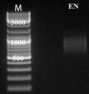 32 - Normalizované ds cdna a jejich koncentrace normalizované ds cdna amplifikace č.