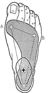 Obrázek č. 3 Základní opěrné body nohy (Sobotka, 1996) 2.4 Chůze Chůze je nejběžnější způsob pohybu.