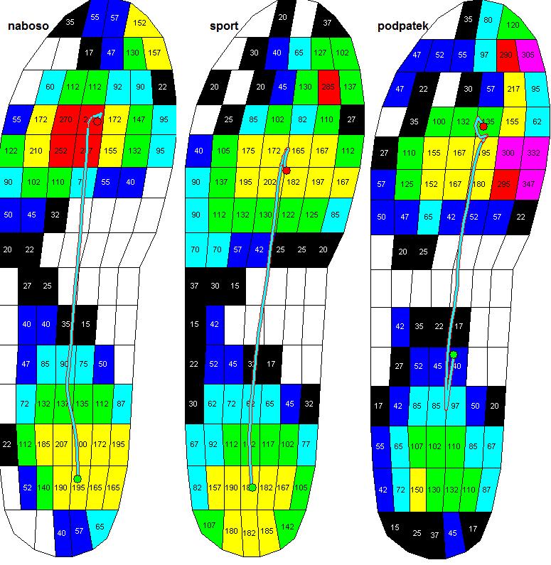 obuvi zatížena nejméně. Celkový maximální tlak (Total) byl též nejvyšší při chůzi na podpatku a to s hodnotou 366,2 kpa.