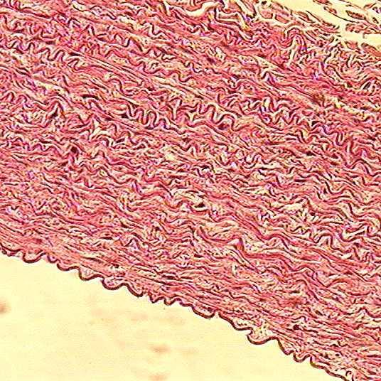 Aorta