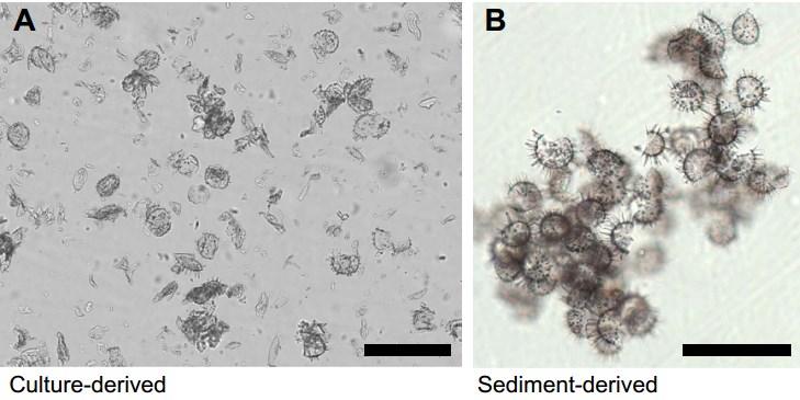 Dinosporiny recentních obrněnek Dinosporin je definován jako makromolekulární odolná organická látka, která tvoří uzavřené nebo částečně uzavřené BS cyst obrněnek, chemická struktura dinosporinu