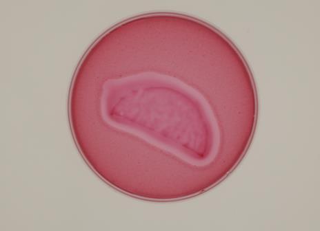 Obal je umístěn na Petriho misce s bakterií Escherichia coli.