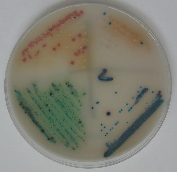 Bakterie na chromogenní půdě