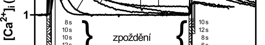 64 Obr. č. 13 Efekt zvyšujících se koncentrací TRH na Ca2+ odpovědi a desenzitizaci v E2 (horní panel) a E2M11 (spodní panel) buňkách.
