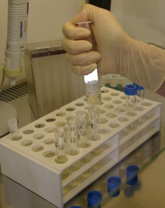 analýzu AFP v radiologické laboratoři, zbytek odstraníme sediment rozplňování