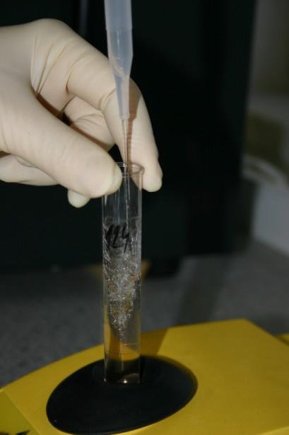 erytrocyty Příklad periferní krev přidání fixativu