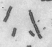 barvení chromosomů Příprava preparátů na ZCA se liší od přípravy preparátů na stanovení karyotypu: materiál periferní krev kultivace buněk v suspenzi 48 hodin s