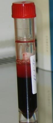 odběr
