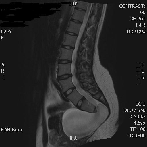 Ultrazvuk versus MRI (CT) v gynekologii preference