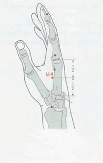 U 3 pacientů dříve proběhla konzervativní terapie (protizánětlivé léky, chondroprotektiva a splint) s mizivým účinkem na kontrolu bolesti.