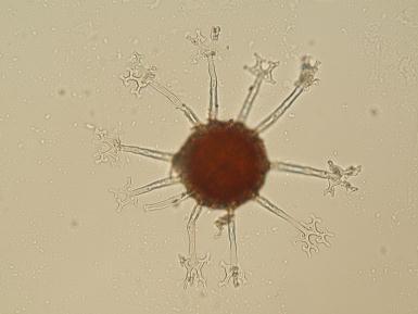1. Determinované druhy z čeledi Erysiphaceae Pro převážnou většinu zástupců této čeledě je typická tvorba bílých myceliálních povlaků na povrchu listu vytvářející zřetelné skvrny i souvislé povlaky.