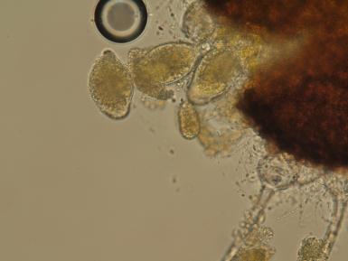 Střední naměřené hodnoty: průměr kleistohecia 237 µm, délka přívěsků 156,2 µm, délka vřecka 61 µm, šířka vřecka 36,8 µm.