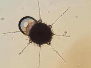 Hyalinní přívěsky jsou šídlovitého tvaru, u báze cibulkovitě rozšířeny, viz obr. č. 8. Od Phyllactinia fraxini se liší hostitelským spektrem a počtem askospor ve vřeckách.
