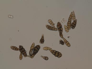 vícebuněčné konidie, viz obr. č. 11. Střední naměřené hodnoty: délka konidií 46,2 µm, šířka konidií 15,6 µm Determinace: Metoda vlhké komůrky, mikroskopický rozbor.
